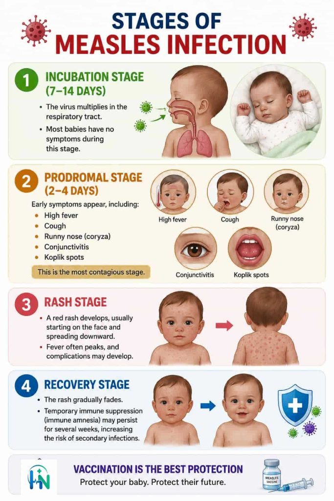 Stages of measles infection