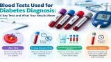 Blood Tests Used for Diabetes Diagnosis: 4 Key Tests and What Your Results Mean Blood Tests Used for Diabetes Diagnosis