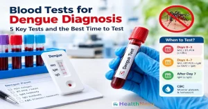 Blood Tests for Dengue Diagnosis