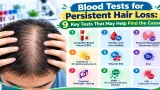 Blood Tests for Persistent Hair Loss: 9 Key Tests That May Help Find the Cause Blood Tests for Persistent Hair Loss
